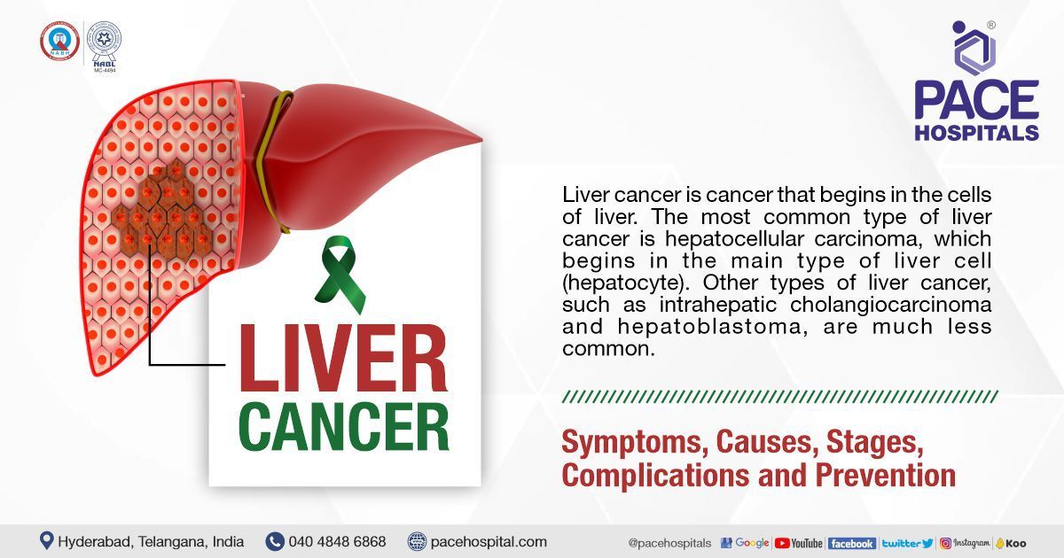 Liver Cancer - Symptoms, Causes, Types, Complications and Prevention