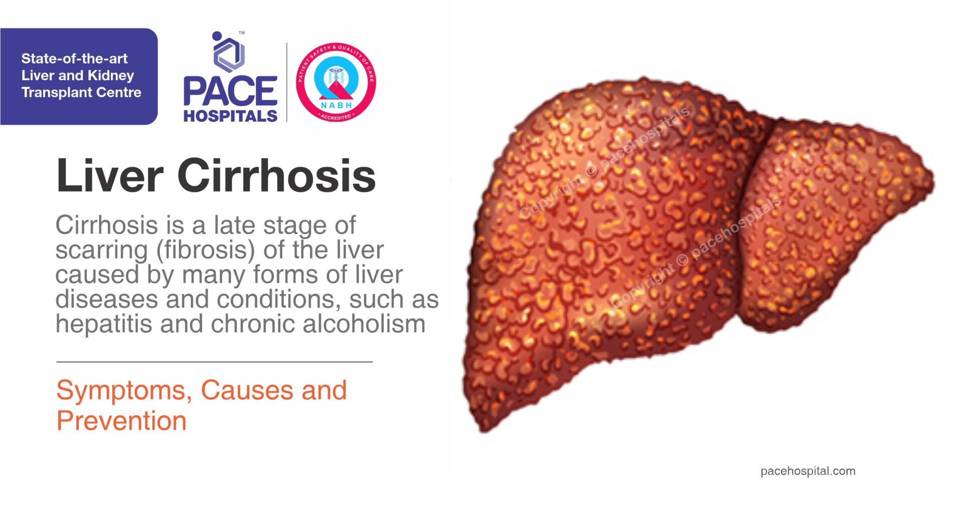 Liver Cirrhosis Stages