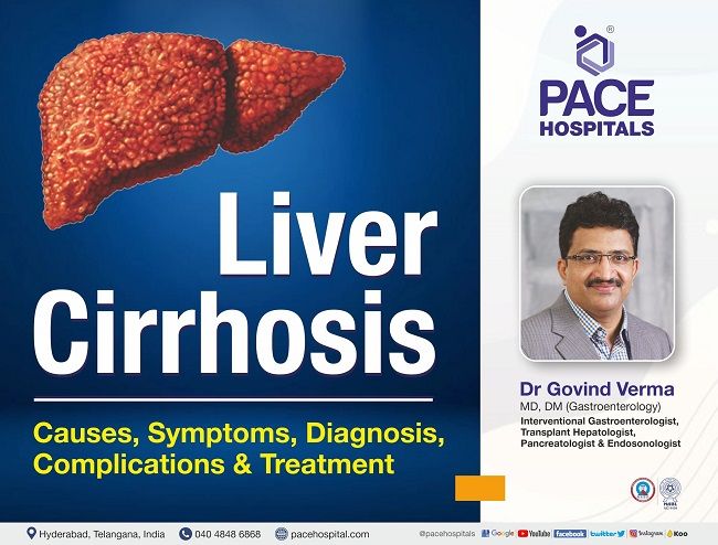 Liver Cirrhosis - Causes, Symptoms, Complications, Diagnosis & Treatment | Dr Govind Verma