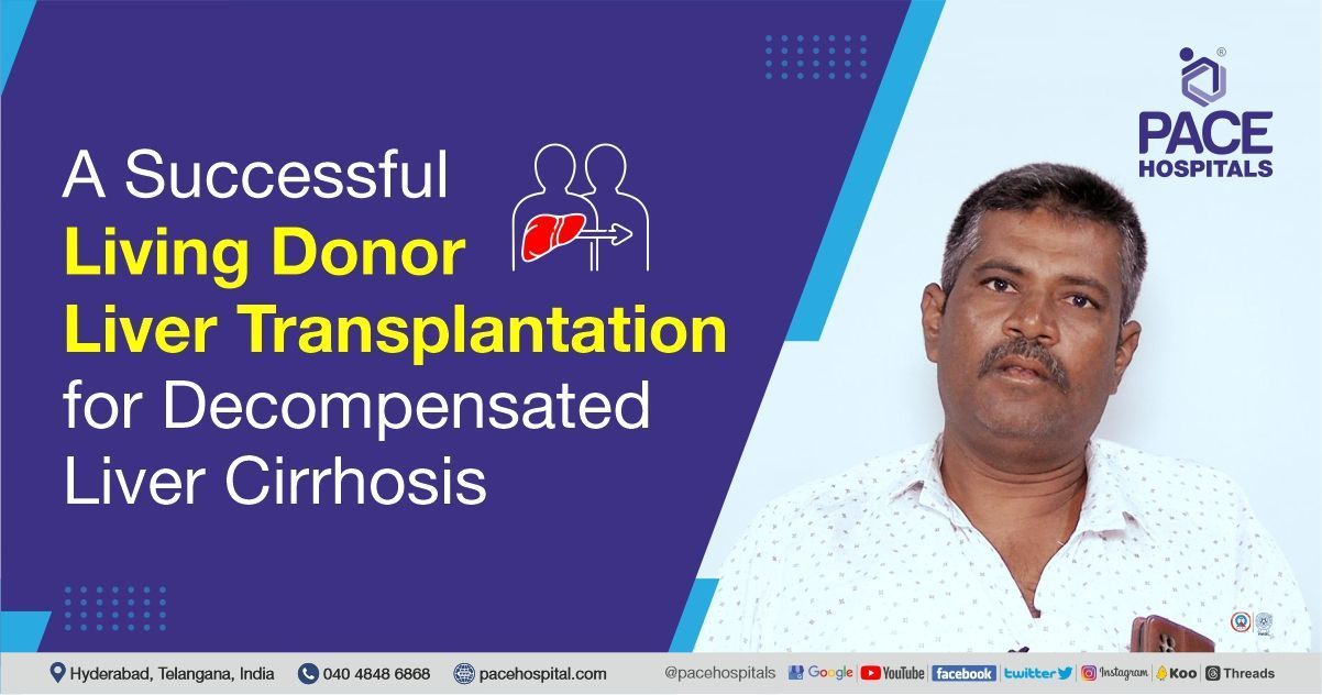 a successful living donor liver transplantation (LDLT) saving a decompensated liver cirrhotic patien
