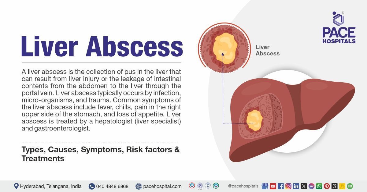 Liver abscess causes and symptoms | Liver abscess treatment in India | What is Liver abscess