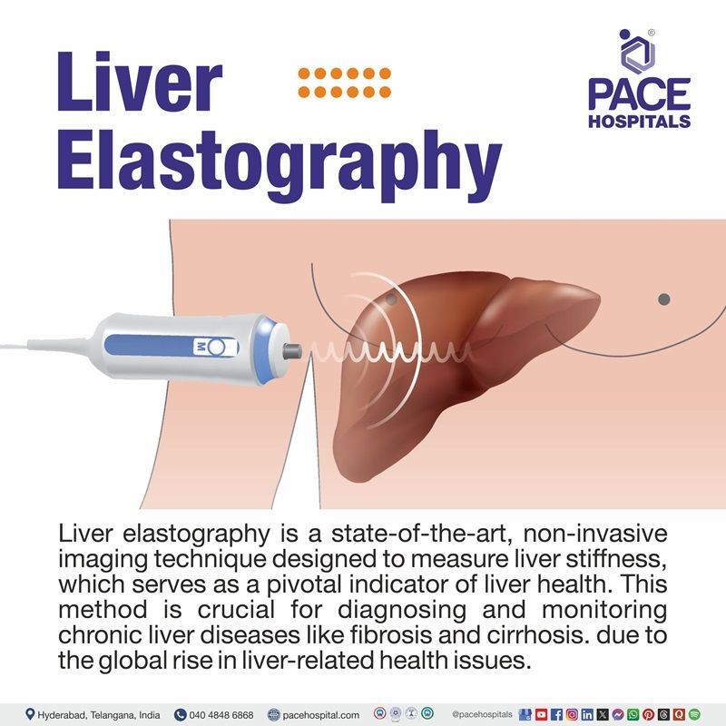 Best hospital for Liver Elastography in Hyderabad | Fibroscan in Telangana India