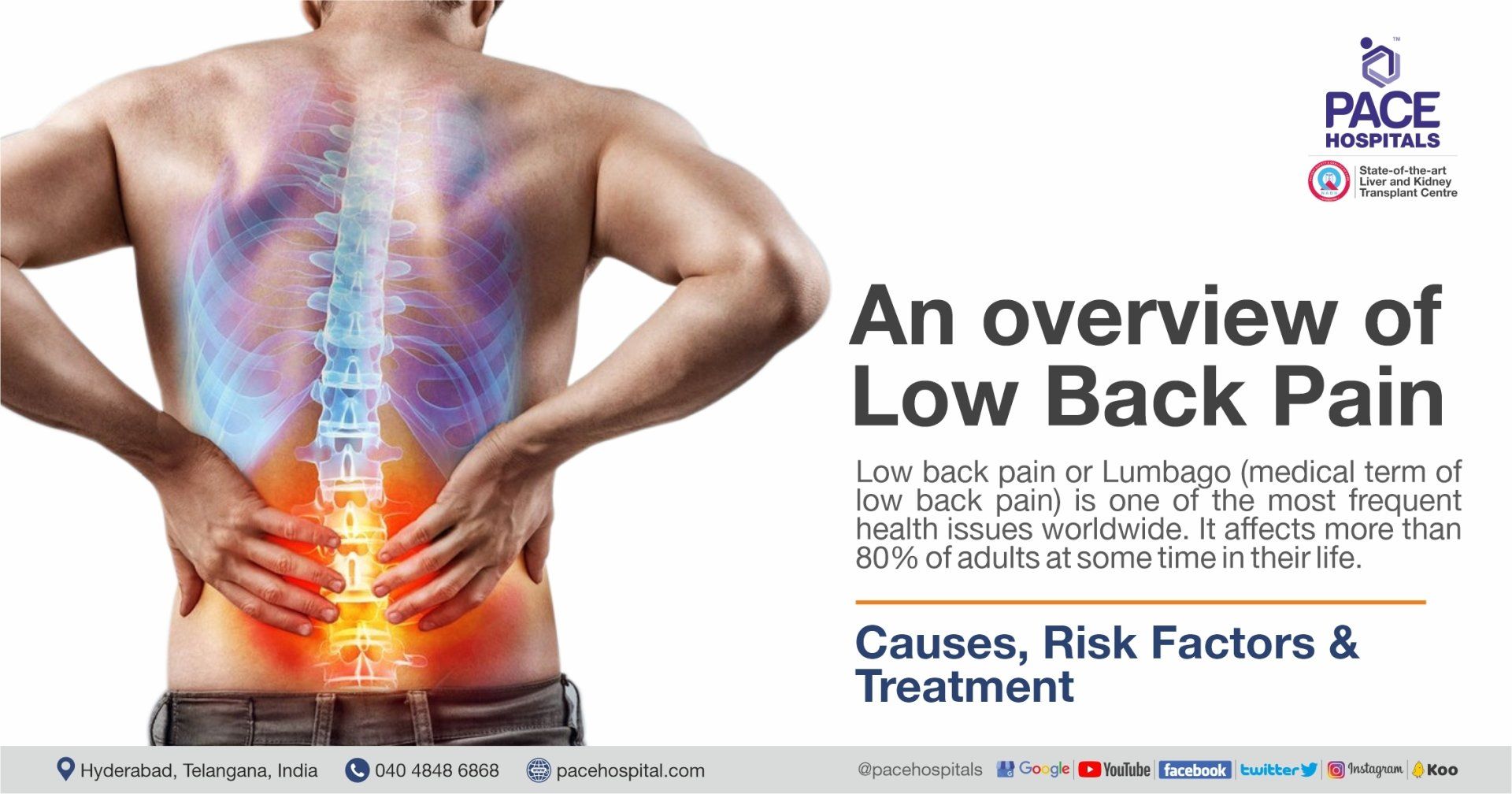 An overview of Low Back Pain | Causes, Risk Factors and Treatment