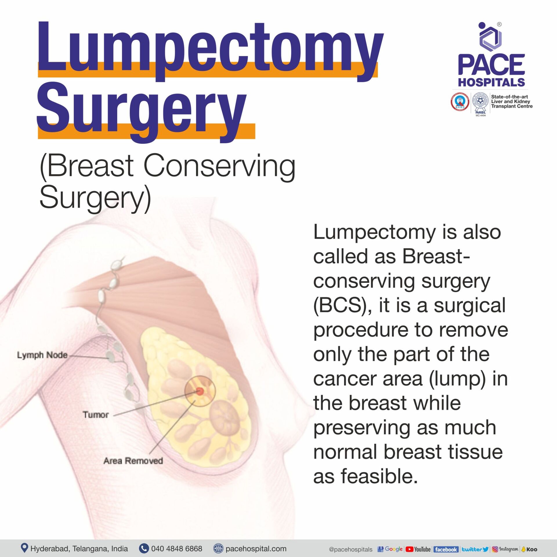Lumpectomy meaning | Lumpectomy surgery | Breast lumpectomy | Breast conserving surgery definition | Breast conserving surgery procedure