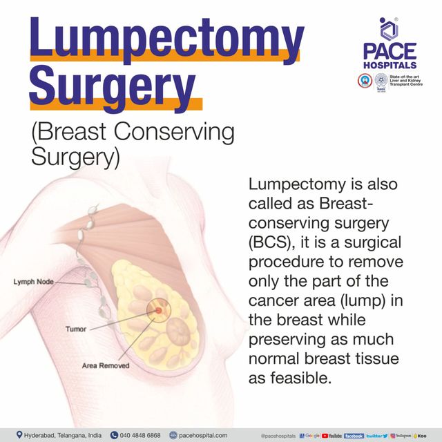 Lumpectomy - Breast Conserving Surgery in Hyderabad