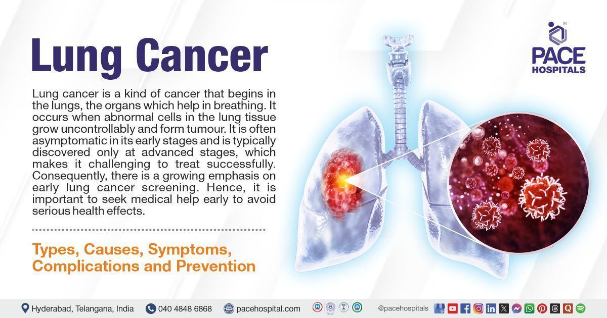 Lung Cancer Causes & Symptoms | Lung Cancer treatment in India | What is Lung cancer