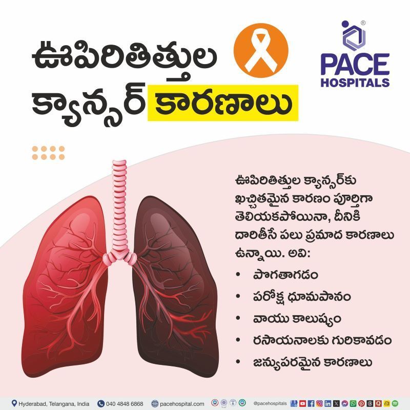 Lung Cancer Causes in Telugu | ఊపిరితిత్తుల క్యాన్సర్ కారణాలు | Causes of Lung Cancer in Telugu