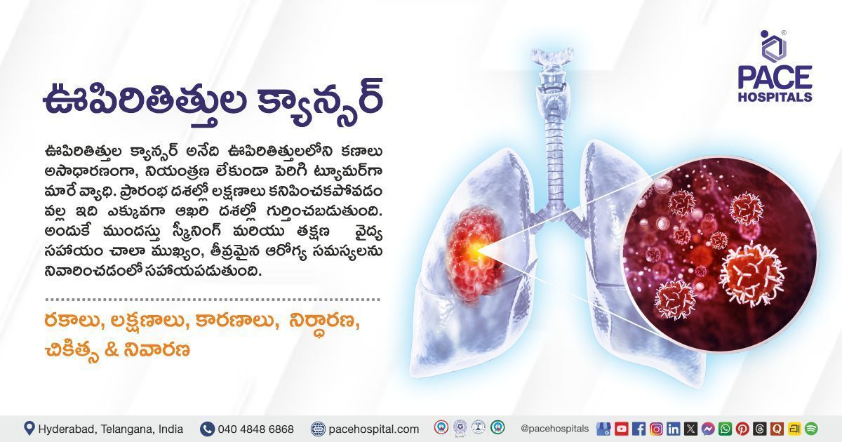 Lung Cancer Symptoms, Causes, Types Diagnosis & Treatment in Telugu | Lung Cancer in Telugu
