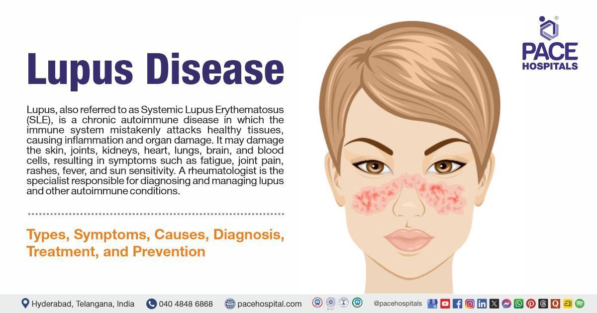 Lupus Disease - Symptoms, Causes, Types, Treatment & Prevention | What is lupus