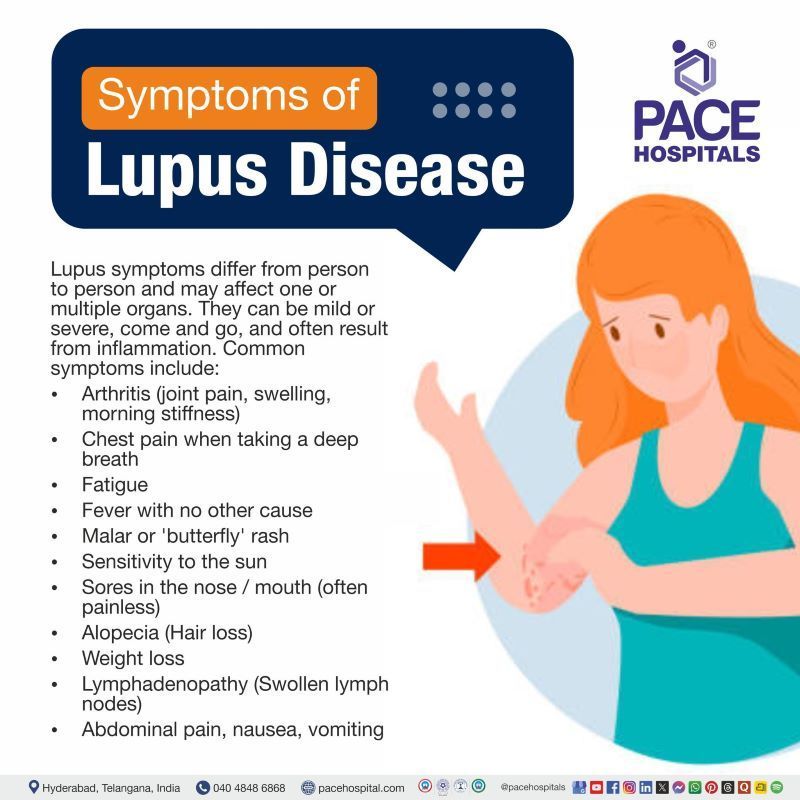 Lupus Symptoms | Lupus symptoms women | Early lupus symptoms