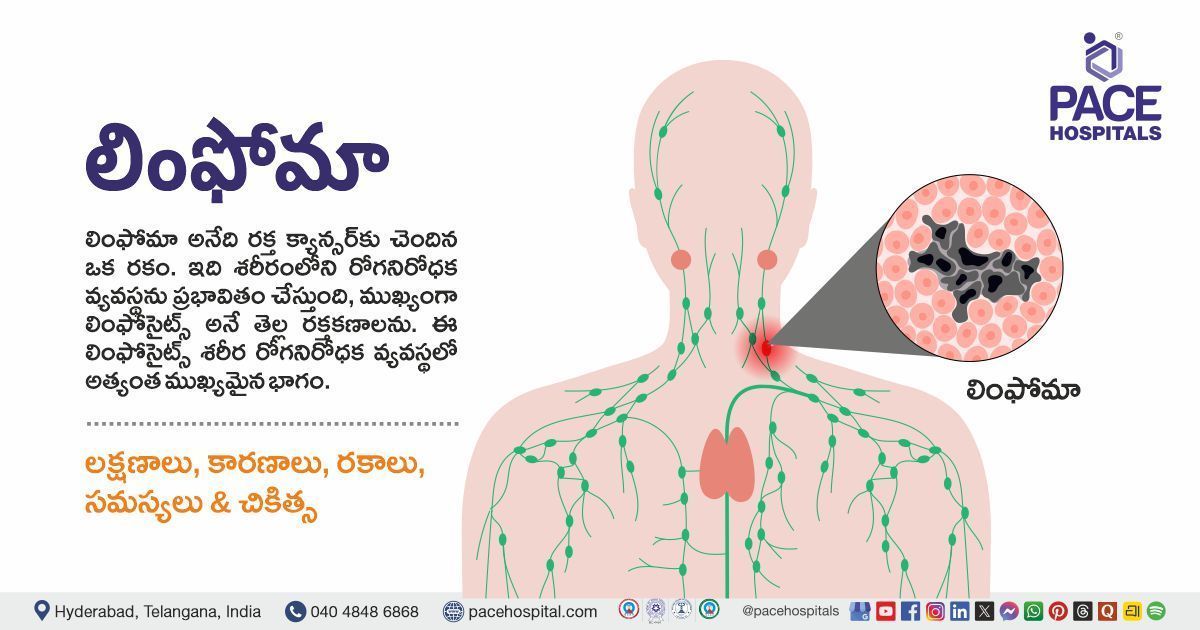 Lymphoma Symptoms, causes, Types, Diagnosis & Treatment in Telugu | Lymphoma in Telugu