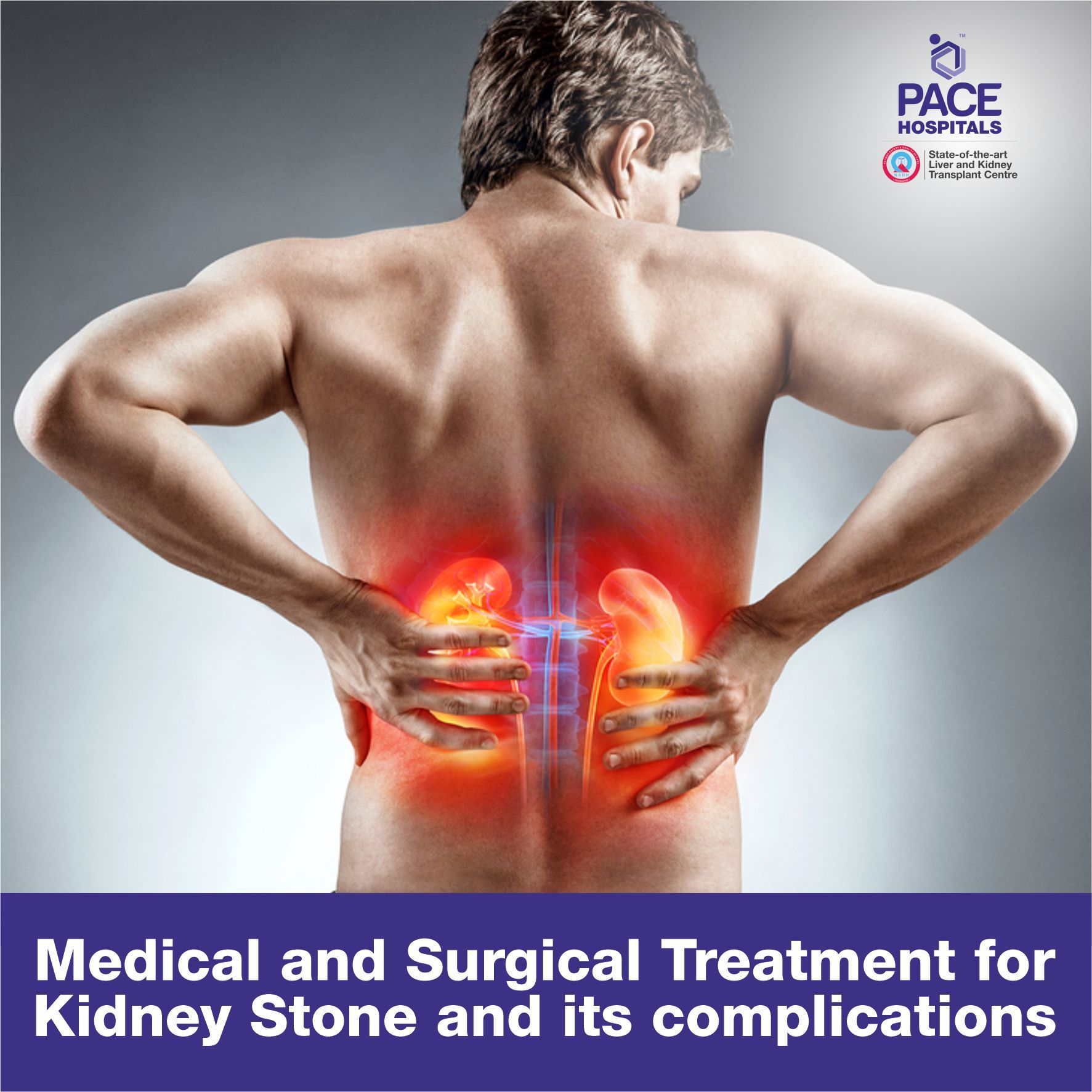 Medical and Surgical Treatment for Kidney Stone and its complications