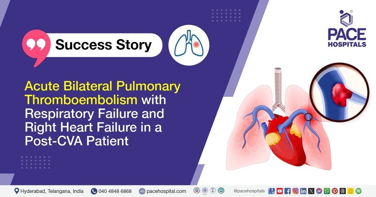 Case study of a 55-year-old male treated for pulmonary thromboembolism at PACE Hospitals.

