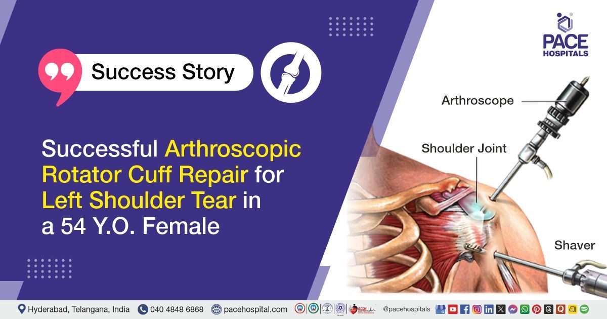 Arthroscopic Rotator Cuff Repair for Left Shoulder Tear done at PACE Hospitals