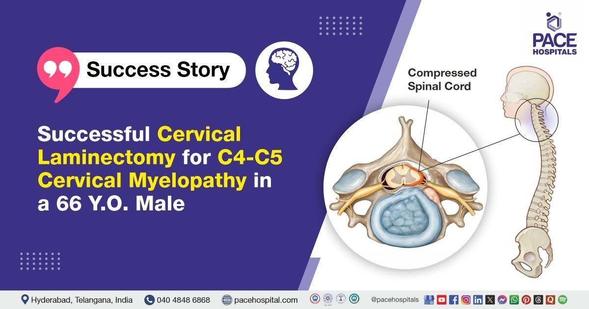 Successful Cervical Laminectomy done for C4-C5 cervical myelopathy at PACE Hospitals