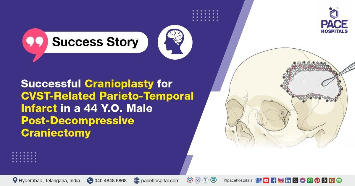 Successful Cranioplasty done for CVST-Related Parieto-Temporal Infarct at PACE Hospitals