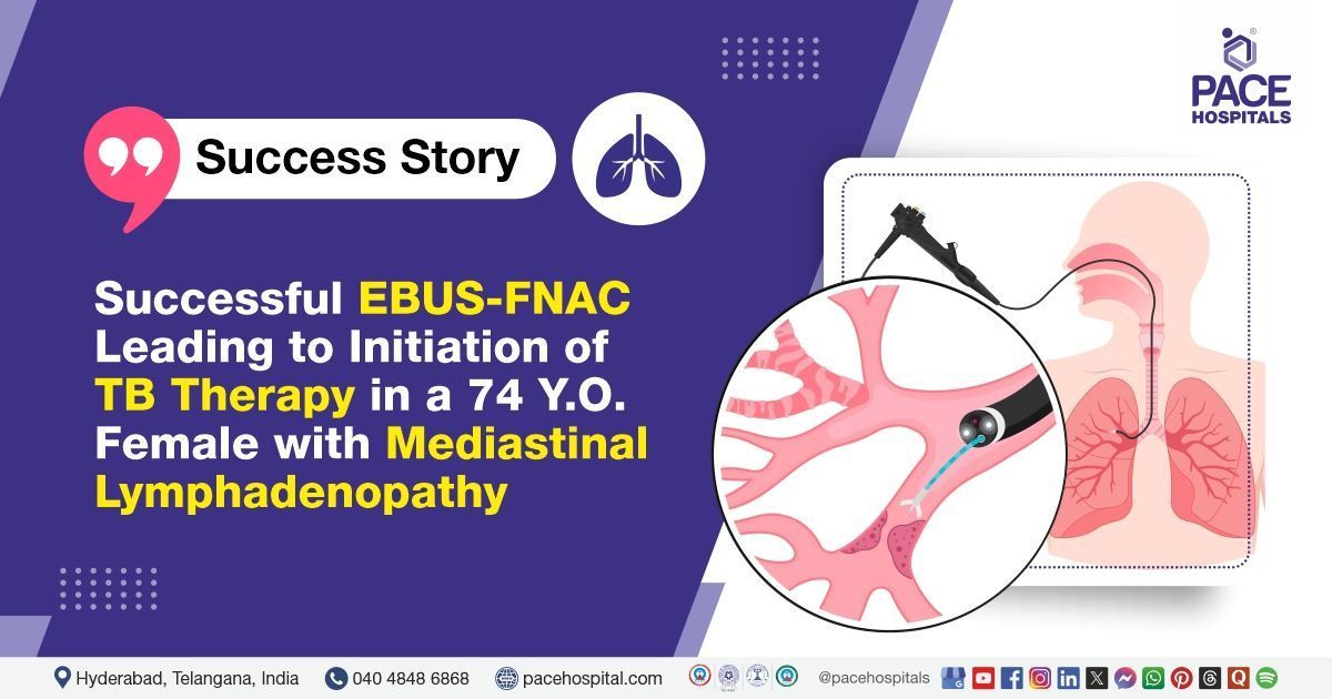 Successful management of Tuberculous Mediastinal Lymphadenopathy through EBUS-FNAC at PACE Hospitals