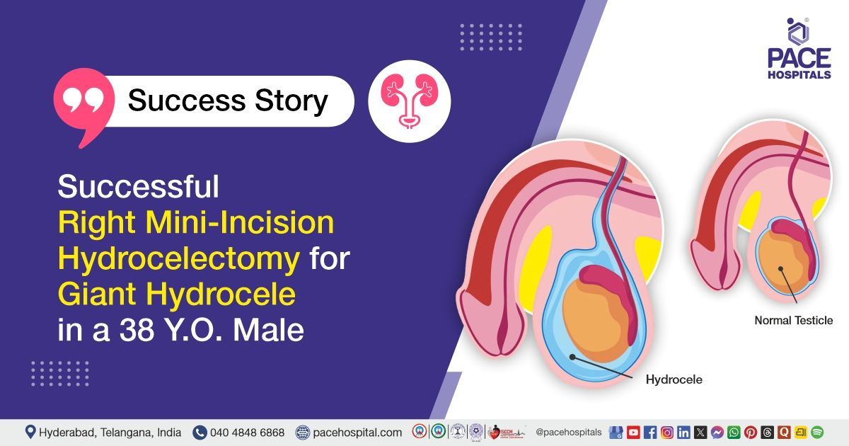 Successful Right Hydrocelectomy for Moderate Hydrocele in a 38 Y.O. Male at PACE Hospitals