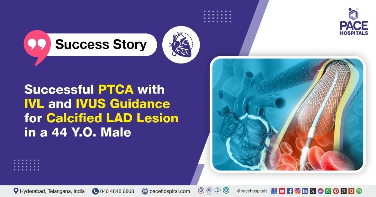 Successful PTCA with IVL and IVUS guided calcified LAD lesion treatment done at PACE Hospitals.