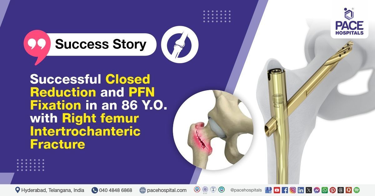 Successful Closed Reduction and PFN Fixation for Right Femur Fracture at PACE Hospitals, Hyderabad