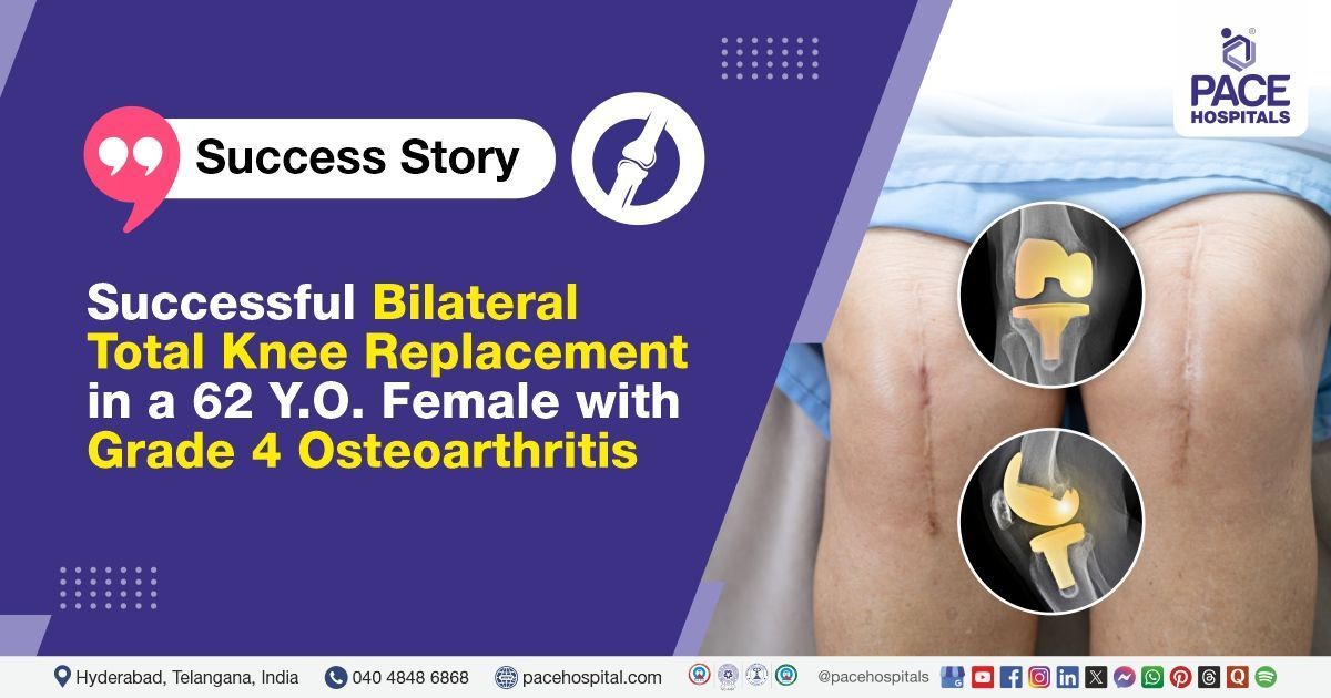 Successful Bilateral Knee Replacement done for Grade 4 Osteoarthritis at PACE Hospitals