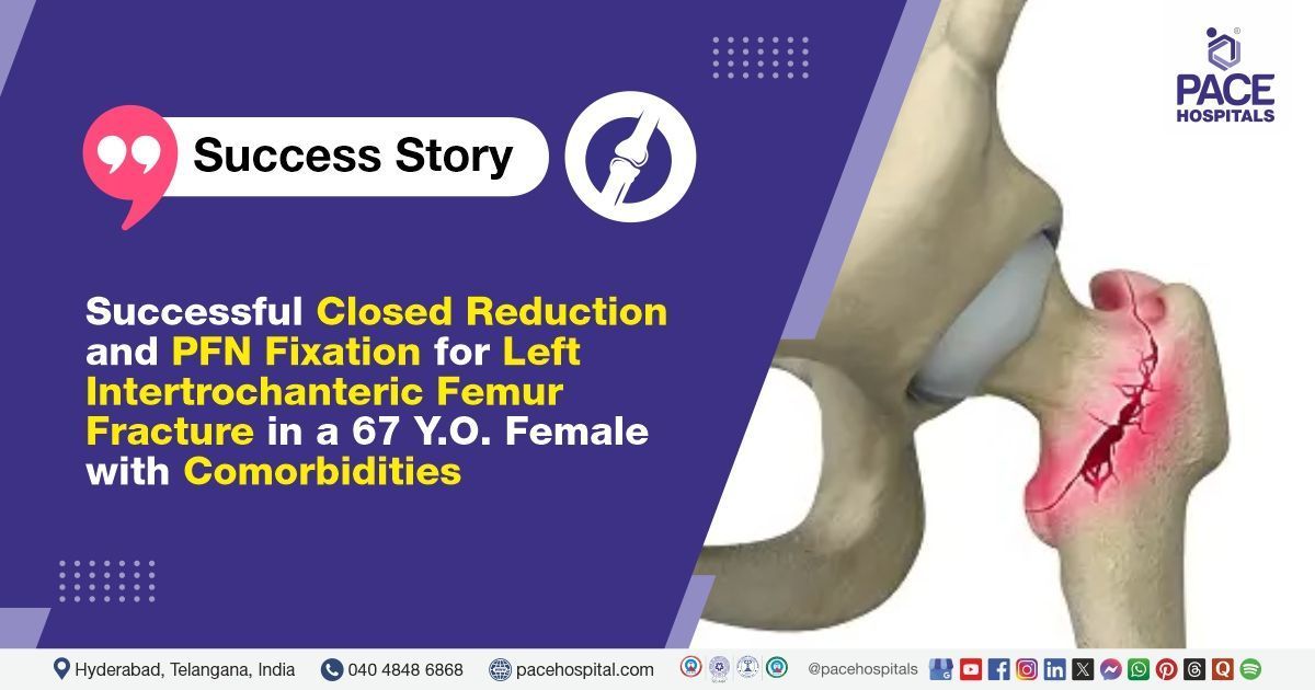 Successful PFN & Closed reduction done for left intertrochanteric femur fracture at PACE Hospitals