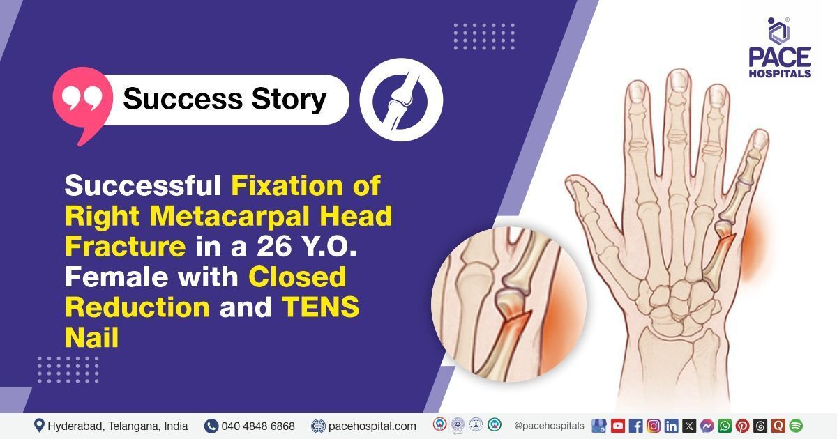 Successful Closed Reduction & TENS Nail done for Metacarpal Head Injury at PACE Hospitals