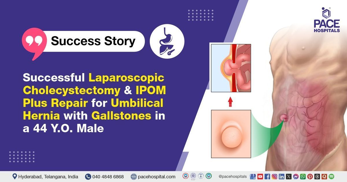 Successful IPOM Plus & Cholecystectomy done for Umbilical Hernia with Gallstones at PACE Hospitals