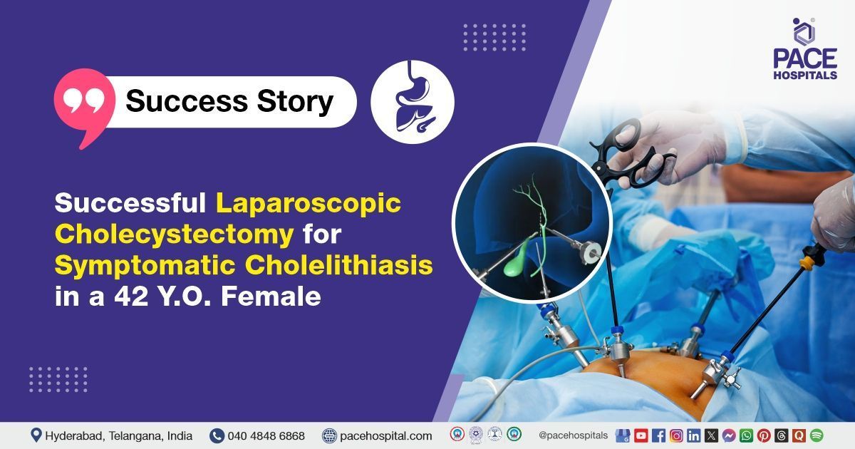 Successful Laparoscopic Cholecystectomy performed for Symptomatic Cholelithiasis at PACE Hospitals