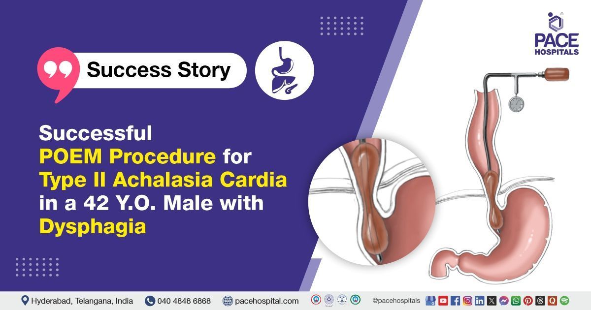 Successful POEM Procedure done for Achalasia Cardia Type 2  with Dysphagia at PACE Hospitals