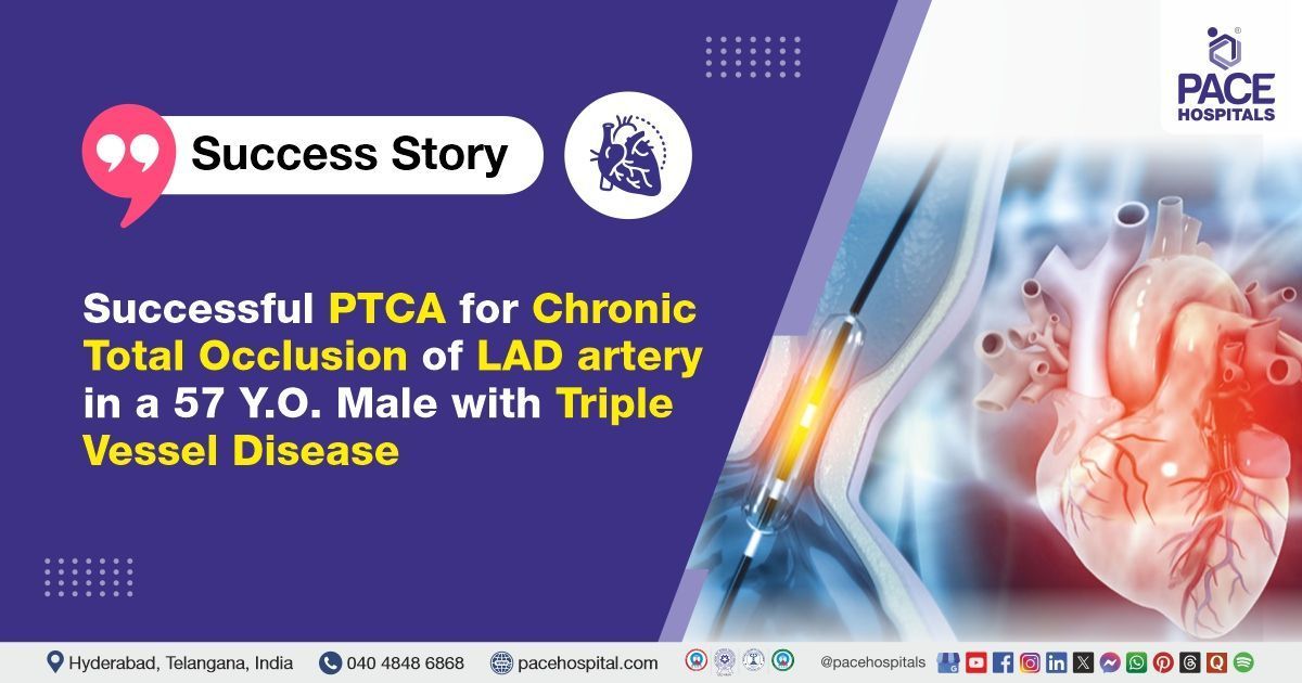 Successful PTCA performed for LAD Artery CTO in Triple Vessel Disease at PACE Hospitals