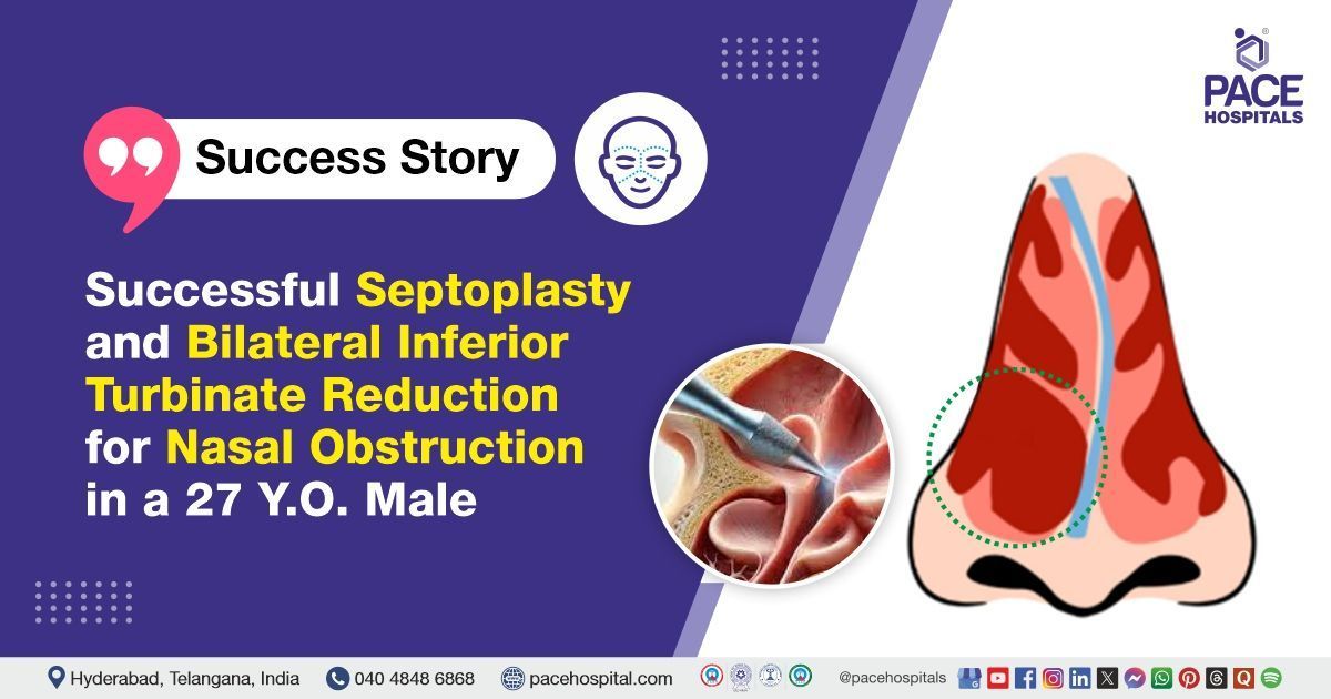 Successful Septoplasty & Bilateral Turbinate Reduction done for Nasal Obstruction at PACE Hospitals	