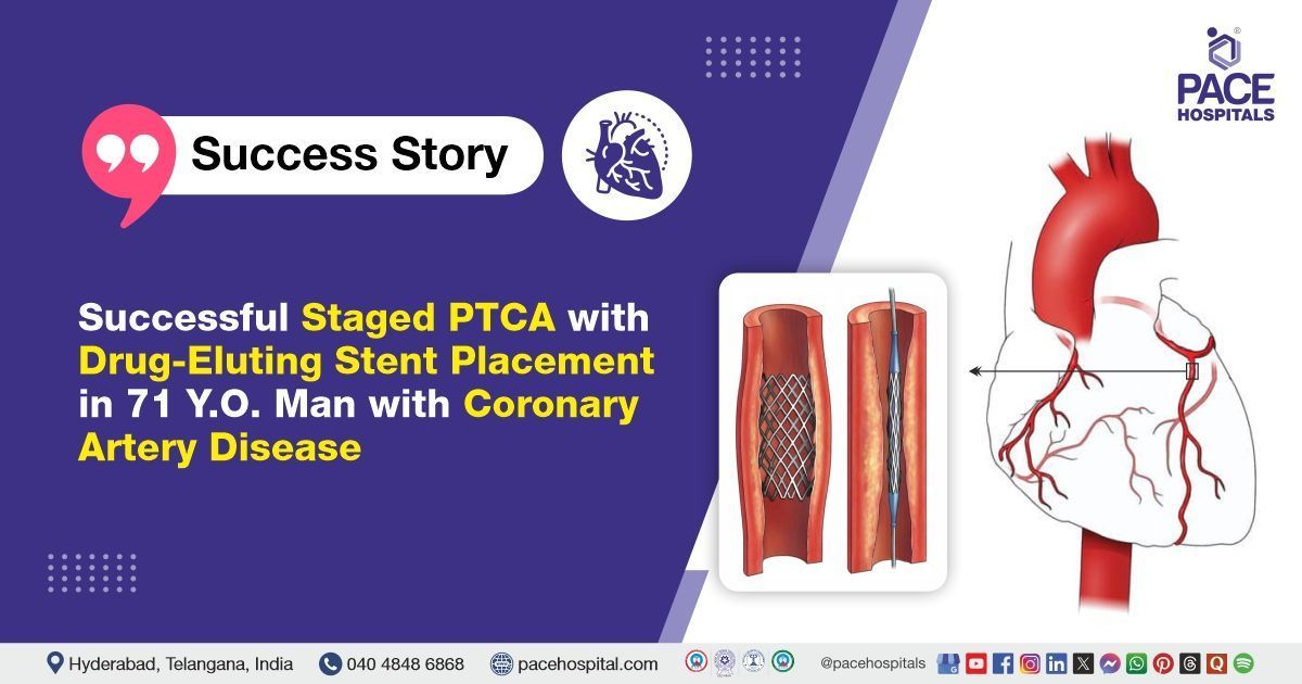 Successful PTCA & Drug-Eluting Stent done for Coronary Artery Disease Treatment at PACE Hospitals