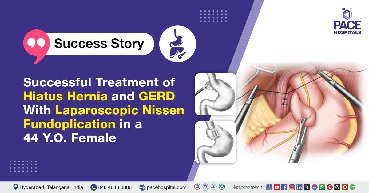 Successfully Hiatus Hernia & GERD treated with Laparoscopic Nissen Fundoplication at PACE Hospitals