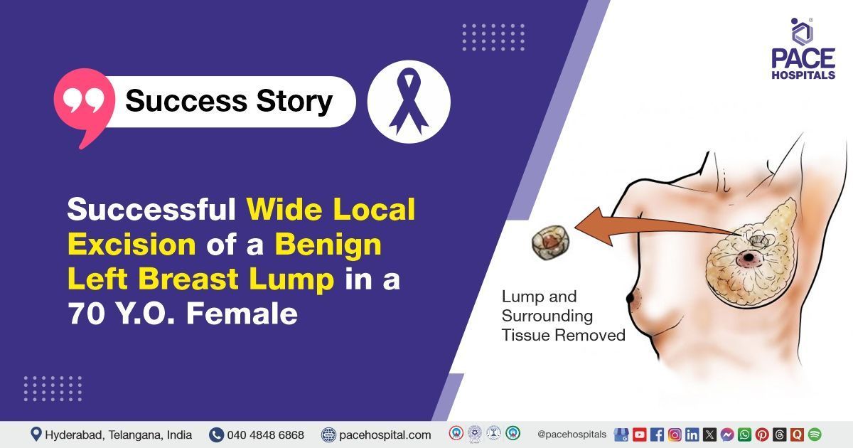 Successful Wide Local Excision of a Benign Breast Lump performed at PACE Hospitals.