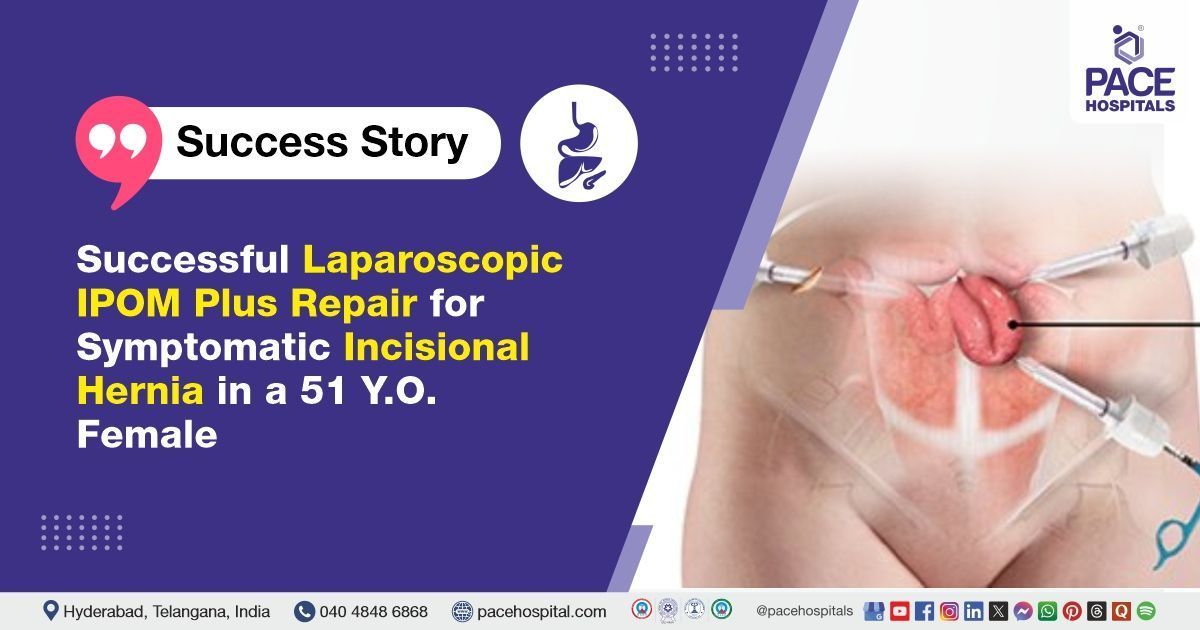 Successful laparoscopic IPOM Plus done for incisional hernia treatment at PACE Hospitals
