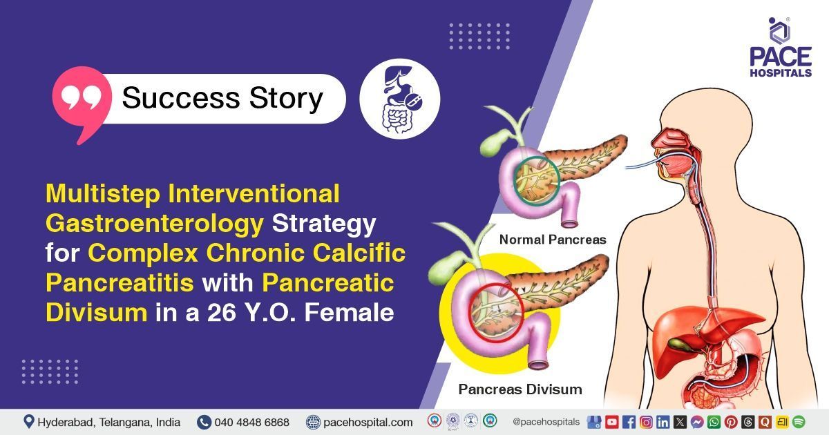 Successful ERCP with PD stent removal done for chronic calcific pancreatitis at PACE Hospitals