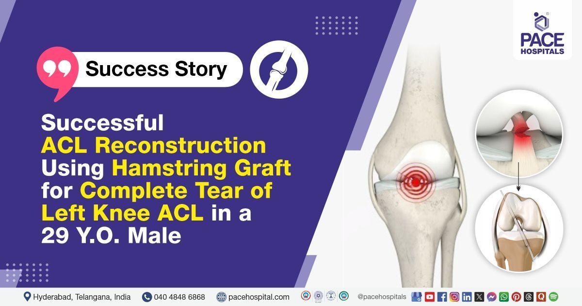 Successful ACL reconstruction with hamstring graft for complete left knee ACL tear at PACE Hospitals