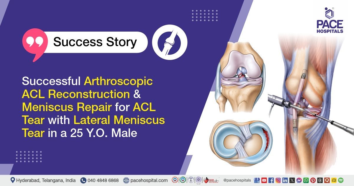 Successful ACL reconstruction and meniscus repair for a complex knee injury at PACE Hospitals