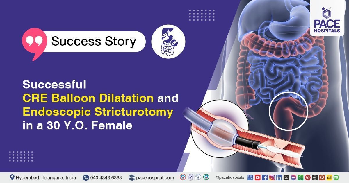 Successful CRE balloon dilatation done for rectosigmoid anastomotic stricture at PACE Hospitals