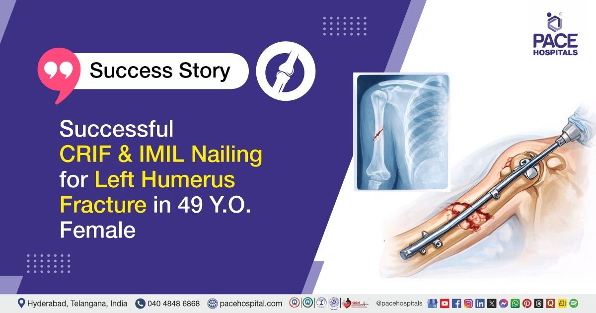 Successful CRIF & IMIL Nailing for Left Humerus Fracture Treatment at PACE Hospitals  