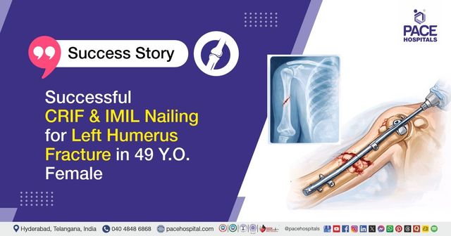 Successful CRIF & IMIL Nailing for Left Humerus Fracture Treatment at PACE Hospitals  