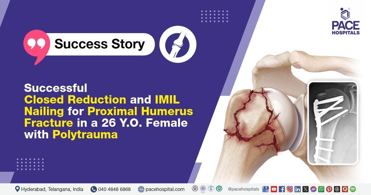 Successful Closed Reduction and IMIL Nailing done for proximal humerus fracture at PACE Hospitals