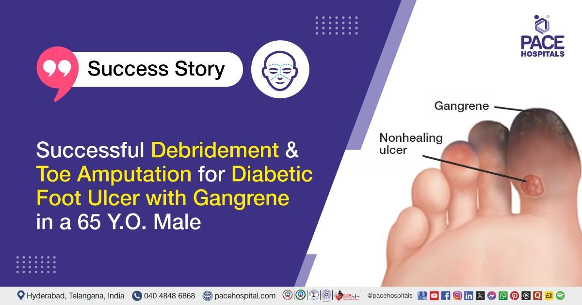 Successful Debridement and Toe Amputation for Diabetic Foot Ulcer with Gangrene at PACE Hospitals