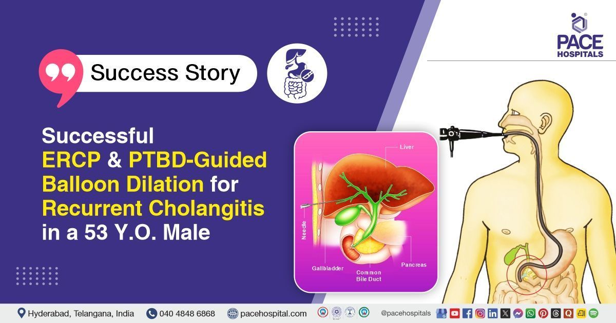 Successful ERCP with PTBD-guided balloon dilation done for recurrent cholangitis at PACE Hospitals.