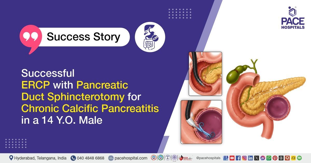 Successful ERCP & Pancreatic Duct Sphincterotomy for Chronic Calcific Pancreatitis at PACE Hospitals