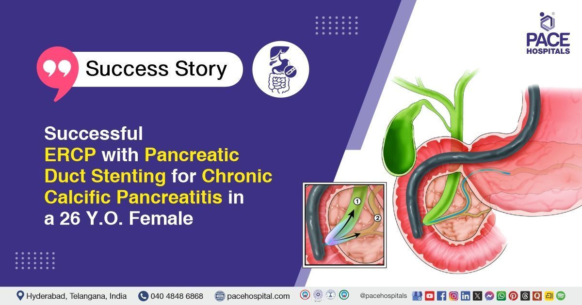 Successful ERCP with Pancreatic Duct Stenting for Chronic Calcific Pancreatitis at PACE Hospitals