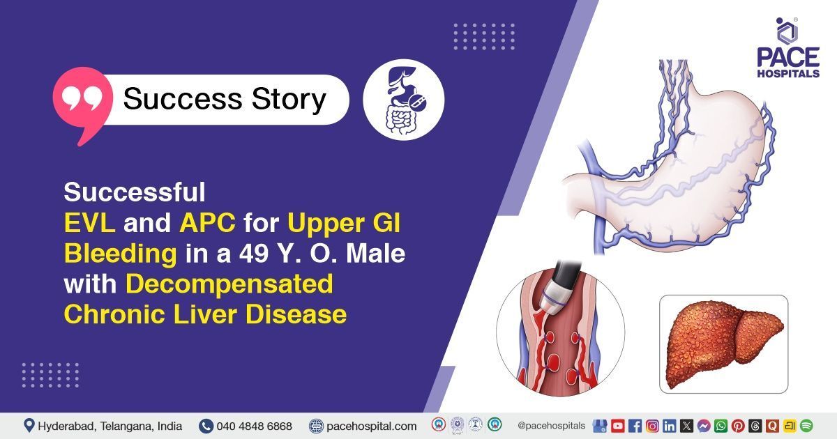 Successful EVL and APC for esophageal varices and duodenal ulcer at PACE Hospitals
