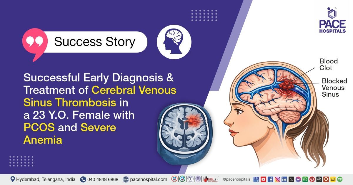 Successful CVST treatment in a 23 Y.O. female with PCOS & anemia at PACE Hospitals