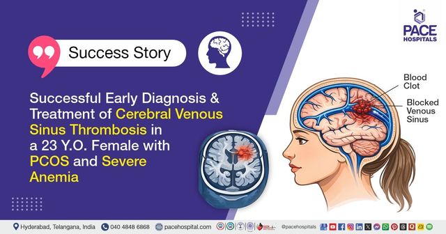 Successful CVST treatment in a 23 Y.O. female with PCOS & anemia at PACE Hospitals
